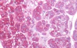 EIG121 Antibody, Novus Biologicals 50 &mu;g | Buy Online | Novus Biologicals | Fisher Scientific